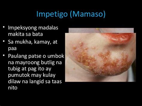 Mga Kundisyon at Sakit sa Balat na Nagdudulot ng .